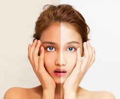 Beyond Whitening: Synlotic Biotechs videnskabelige tilgang til lysere, ensartet hud